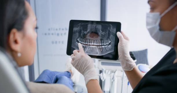 Licensed Tooth Extraction service in South Henderson, NC - Smile Center Dentistry